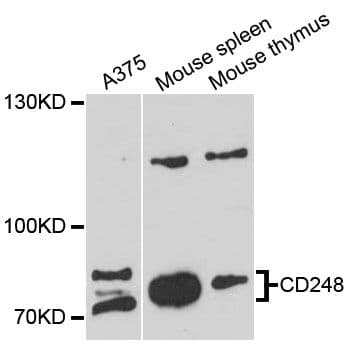 TEM1 / CD248 Antibody