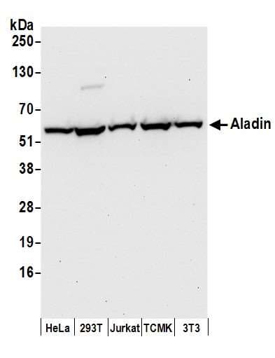 AAAS / Adracalin Antibody (aa496-546)