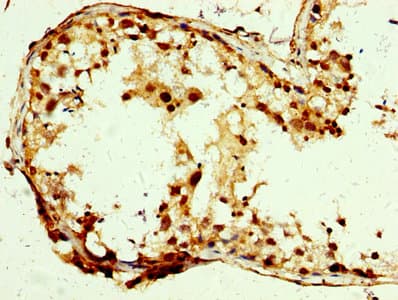 Polyclonal Rabbit anti-Human SLC25A24 / APC1 Antibody (IHC, IF, WB)