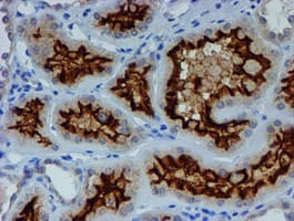 ER Alpha / Estrogen Receptor Antibody (clone OTI1B1)