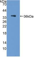 PODXL / Podocalyxin Antibody (aa153-386, Biotin)