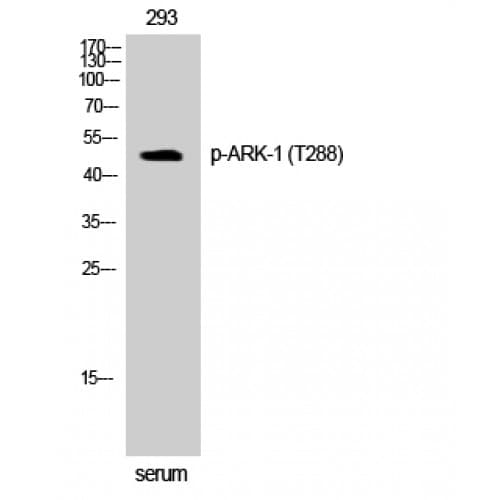 Polyclonal Rabbit anti-Human AURKA / Aurora-A Antibody (230-310 aa, IHC, WB)