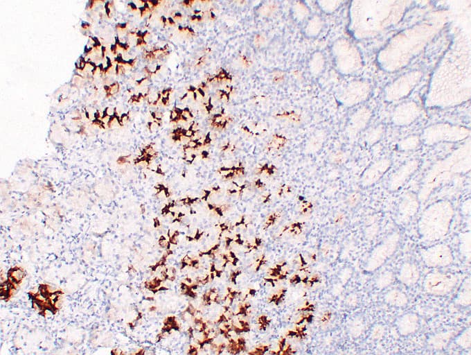 MUC6 / MUC-6 Antibody (clone ABT-MUC6)