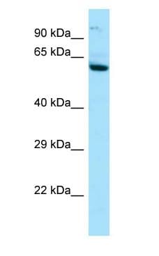 Polyclonal Rabbit anti-Human IL2RB / CD122 Antibody (aa362-411, WB)