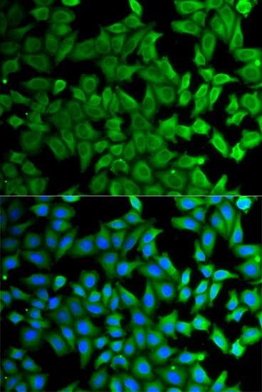 KLKB1 / Plasma Kallikrein Antibody