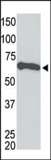 Myc Tag Antibody