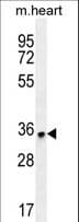 Polyclonal Rabbit anti-Human ZNF524 Antibody (aa195-223, WB)