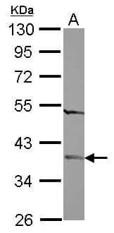 FAM164A / CGI-62 Antibody