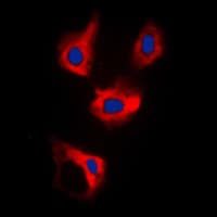 Polyclonal Rabbit anti-Human CDCA3 Antibody (C-Terminus, IHC, IF, WB)