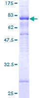 Human STARD3 / MLN64 Protein (Recombinant GST)