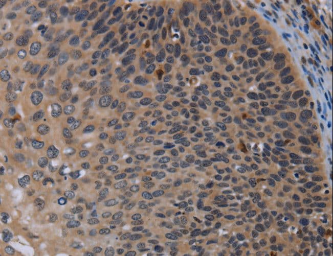 Polyclonal Rabbit anti-Human P2RX2 / P2X2 Antibody (IHC, WB)