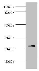 Polyclonal Rabbit anti-Human BIRC8 / ILP2 Antibody (aa1-236, WB)
