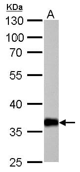 IHC-plus™ DDH / AKR1C1 Antibody (aa22-248)