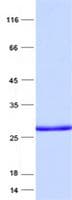 Human PRGP2 / PRRG2 Protein (Recombinant His, N-Terminal)