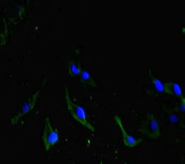 CDC73 / Parafibromin Antibody