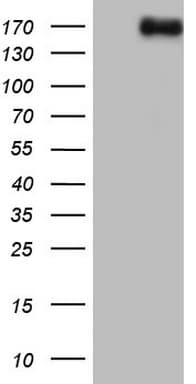 NCOA2 / TIF2 Antibody (aa1-280, clone OTI7G5)