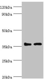 Polyclonal Rabbit anti-Human BRCC3 / BRCC36 Antibody (aa1-316, IHC, WB)