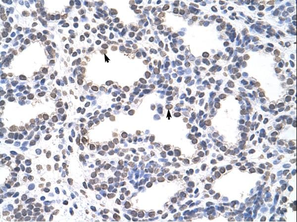 Polyclonal Rabbit anti-Human CARS1 / CARS Antibody (aa661-710, IHC, WB)