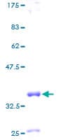 Human CLPS / Colipase Protein (Recombinant GST)