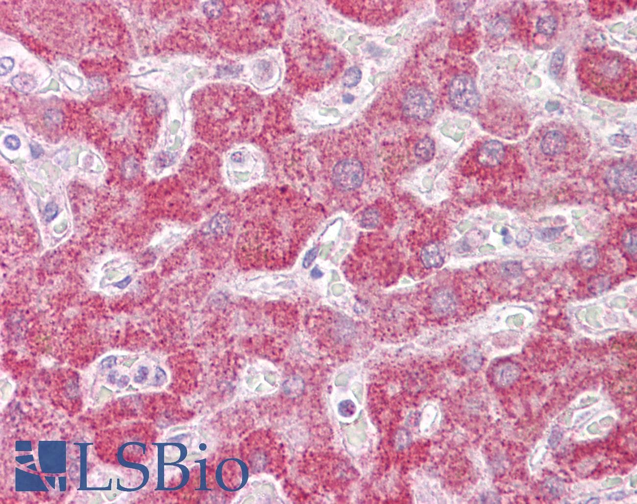 IHC-plus™ Leukotriene B4 Receptor / BLT1 Antibody