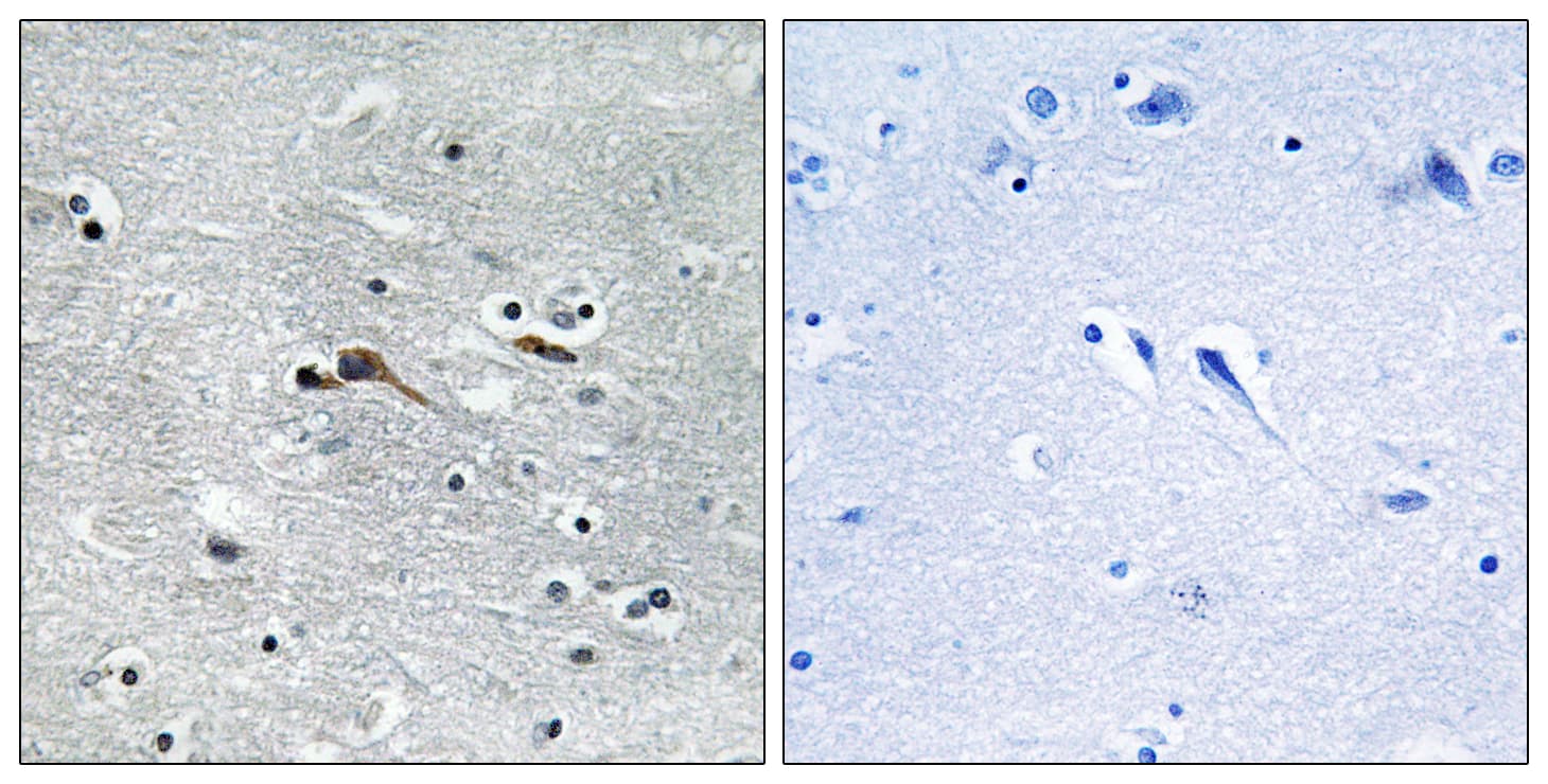Polyclonal Rabbit anti-Human CYTL1 / C17 Antibody (aa61-110, IHC, WB)