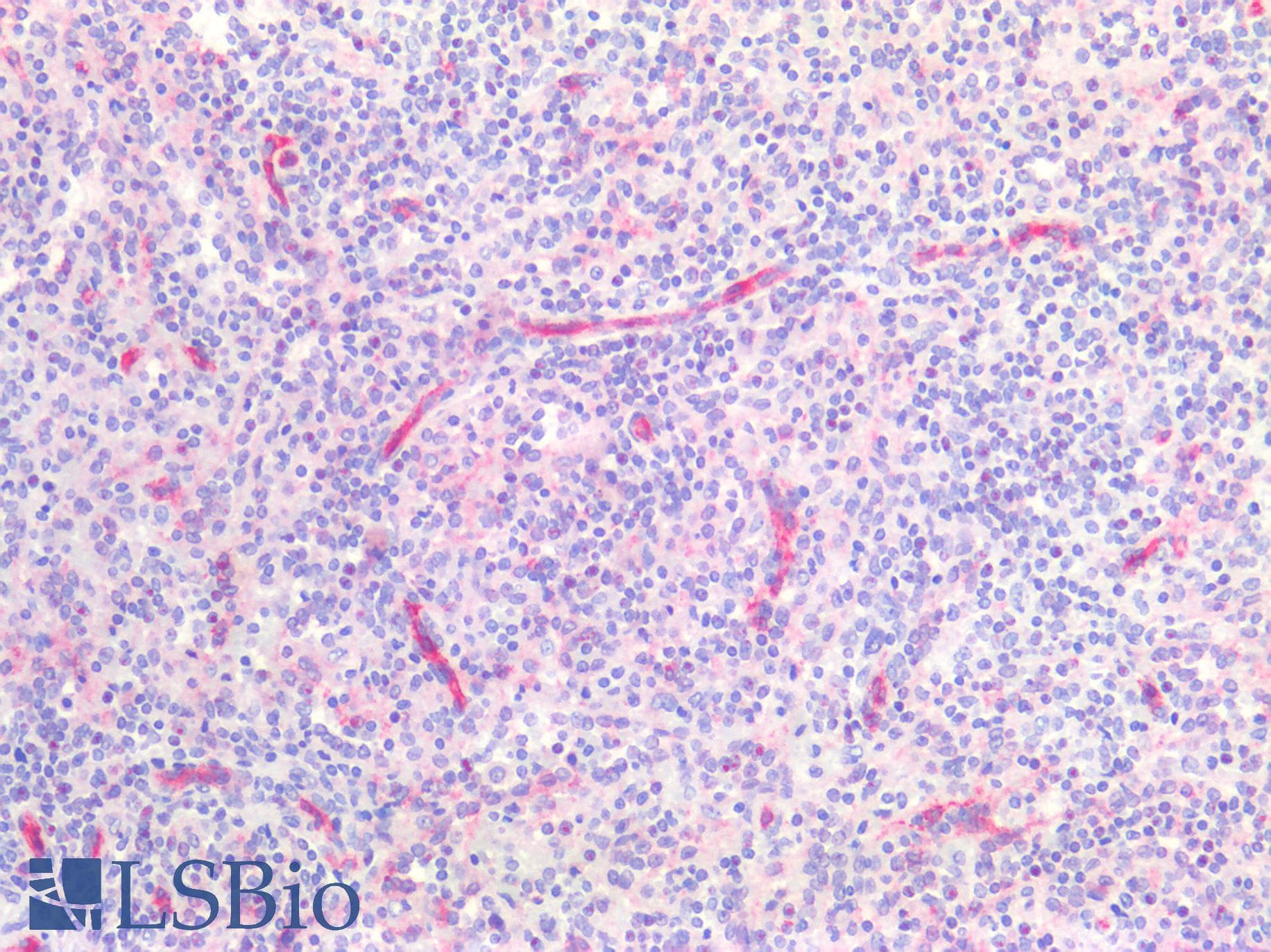 PathPlus™ CLDN5 / Claudin 5 Antibody (C-Terminus)
