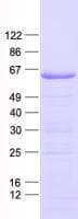 Human SPATA16 / NYD-SP12 Protein (Recombinant His, N-Terminal)