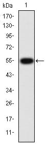 Monoclonal Mouse anti-Human MMP9 / Gelatinase B Antibody (clone 5G3, IHC, IF, WB)