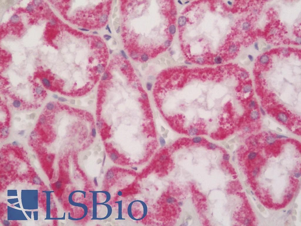 IHC-plus™ Polyclonal Rabbit anti-Human MAPK8IP1 / JIP1 Antibody (aa470-498, IHC, IF, WB)