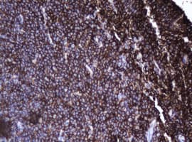 CD20 Antibody (clone OTI3C4)