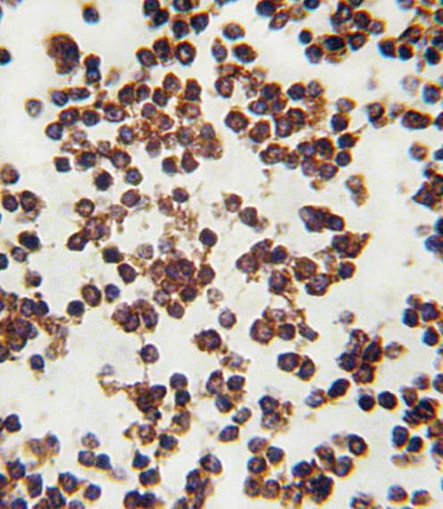 ALOX15 / 15-Lipoxygenase Antibody (aa610-643)