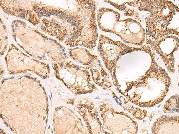 Polyclonal Rabbit anti-Human ECH1 Antibody (IHC, WB)