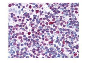 Polyclonal Rabbit anti-Human CREB1 / CREB Antibody (phospho-Ser133, IHC, IF, WB)