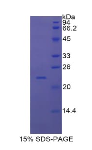 Mouse IFNA7 / Interferon Alpha 7 Protein (Recombinant His-T7)