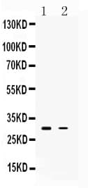 TNFAIP6 / TSG-6 Antibody