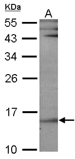 HR6B / UBE2B Antibody