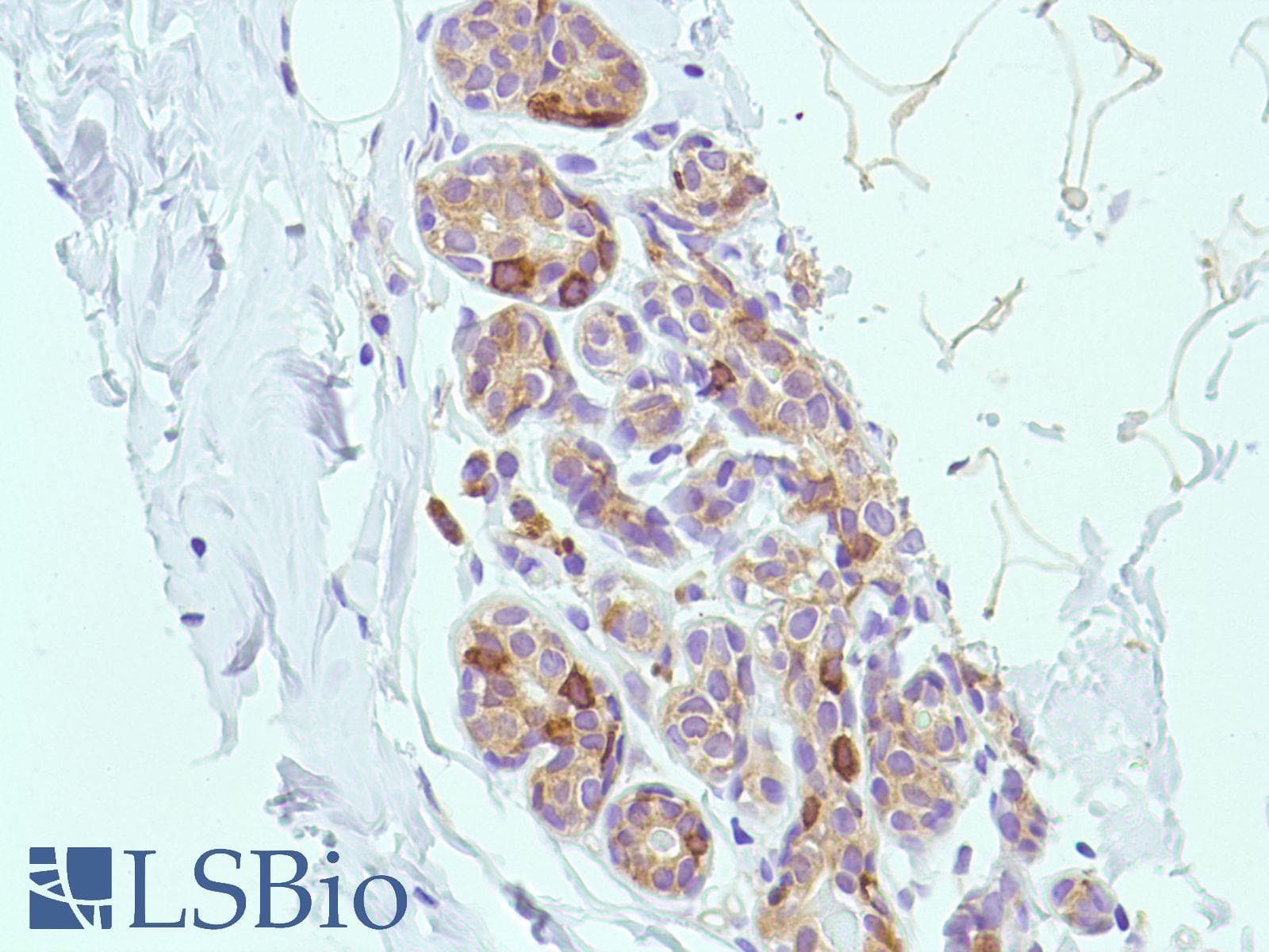 PTGS2 / COX2 / COX-2 Antibody (C-Terminus, clone SP21)