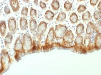 CTNNB1 / Beta Catenin Antibody (clone CTNNB1/1507, Azide-free, BSA-free)
