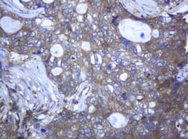 RAB21 Antibody (clone OTI5B12)