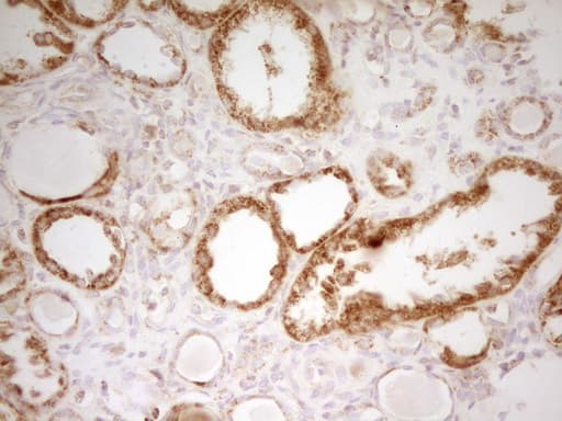 Monoclonal Mouse anti-Human MRRF Antibody (clone OTI2A9, aa56-262, IHC, WB)