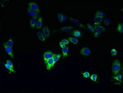 Polyclonal Rabbit anti-Human CYP4F11 Antibody (aa38-524, WB)