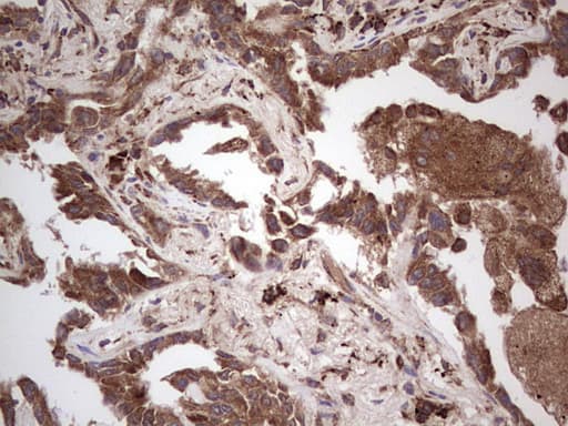 RET Antibody (aa713-1017, clone OTI21H4)