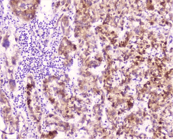 Polyclonal Rabbit anti-Human CRP / C-Reactive Protein Antibody (IHC, WB)
