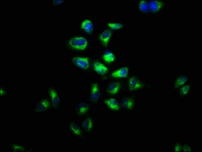 Polyclonal Rabbit anti-Human GPR48 / LGR4 Antibody (IHC)