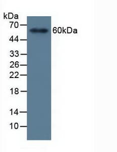 MMP19 Antibody (aa98-508)