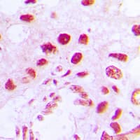 RAD51L3 / RAD51D Antibody (Internal)