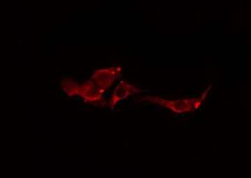Polyclonal Rabbit anti-Human CLDN8 / Claudin 8 Antibody (IF, WB)