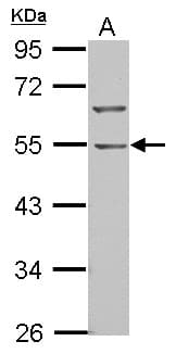 BTBD10 / GMRP-1 Antibody