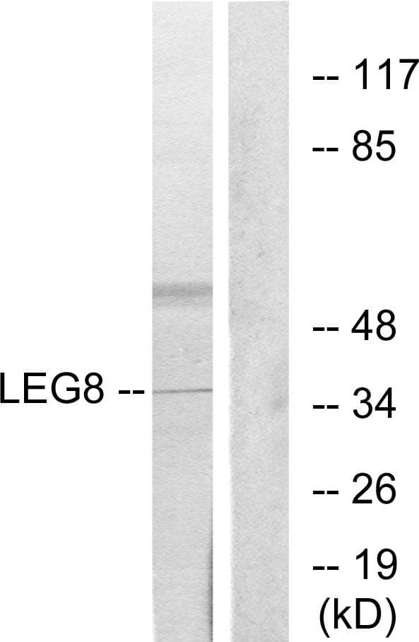 LGALS8 / Galectin 8 Antibody