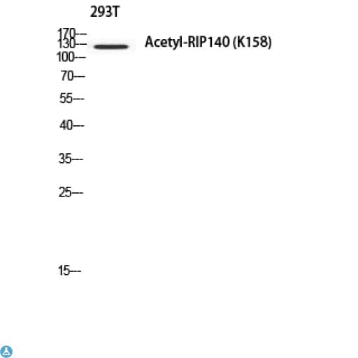NRIP1 / RIP140 Antibody